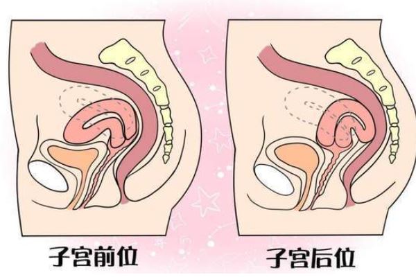 子宮后位懷孕成功幾率有多少?子宮后位是什么原因引起的?